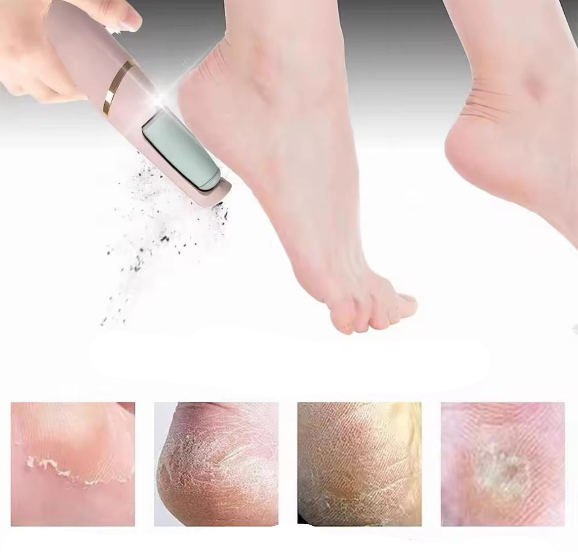 Electric Callus Remover-Pedicure Foot File